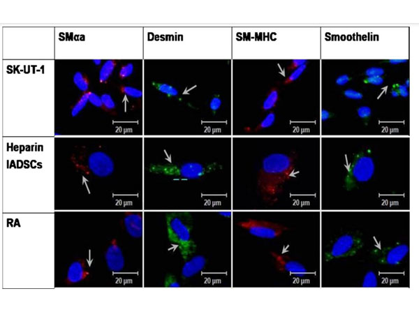 Immunofluorescence using Rabbit Anti-Mouse IgG1 FITC